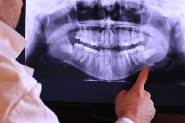 Best Emergency Gum Treatment in Rowland Heights, CA