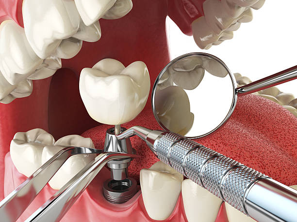 Best Same-Day Emergency Dental Services in Rowland Heights, CA